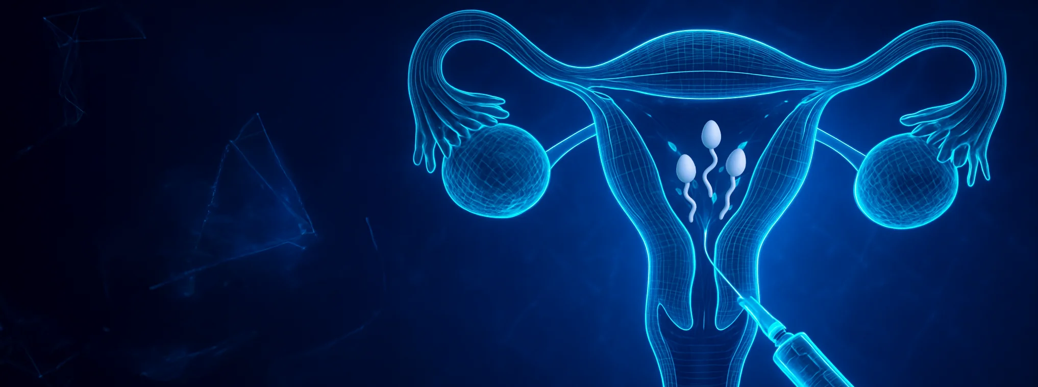 Intrauterine insemination